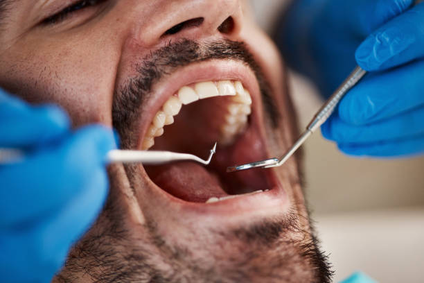 Professional Emergency Dentist in DE