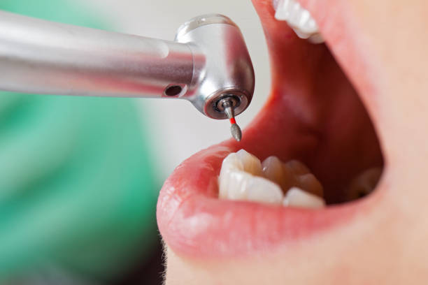 Best Broken or Cracked Tooth Emergency Dentist in Dover, DE